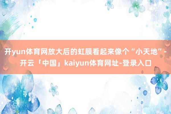 开yun体育网放大后的虹膜看起来像个“小天地”-开云「中国」kaiyun体育网址-登录入口